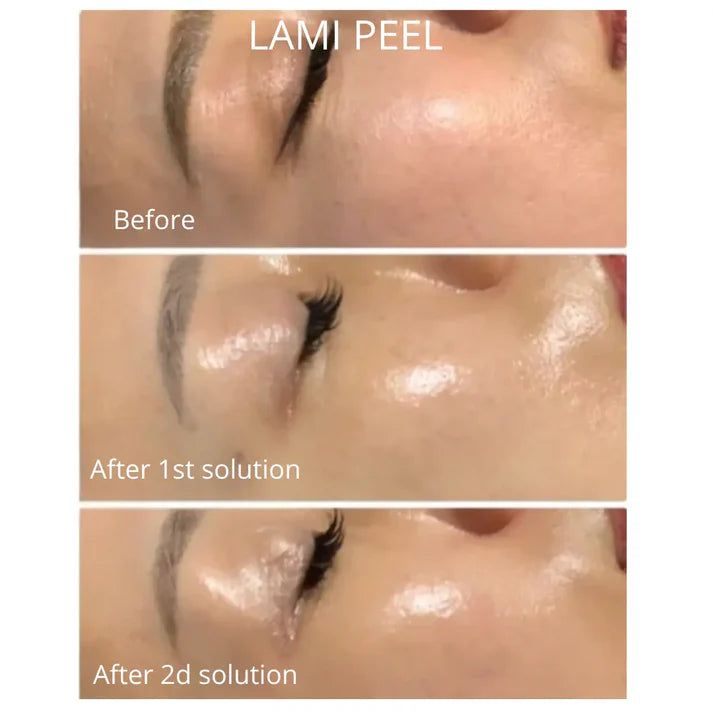 DM Cell - Peeling (Korean Glass Skin) - LAMI Peel (PHA+LHA+AHA) Reconstruction - 라미필
