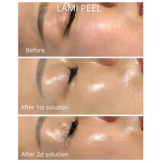 DM Cell - Peeling (Korean Glass Skin) - LAMI Peel (PHA+LHA+AHA) Reconstruction - 라미필