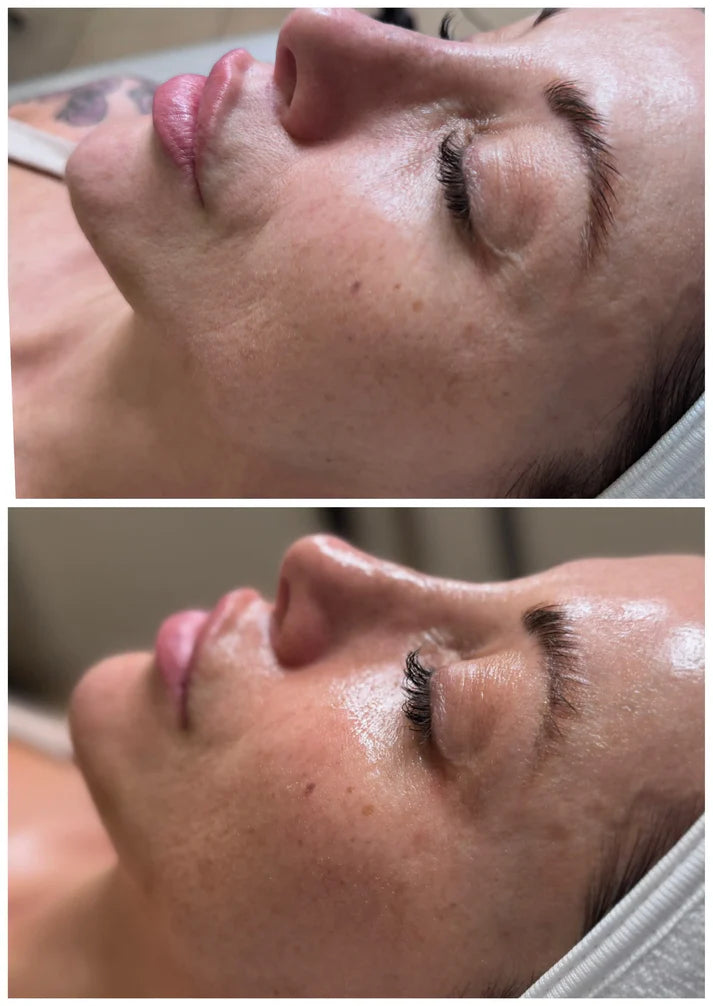 DM Cell - Peeling (Korean Glass Skin) - LAMI Peel (PHA+LHA+AHA) Reconstruction - 라미필