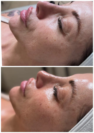 DM Cell - Peeling (Korean Glass Skin) - LAMI Peel (PHA+LHA+AHA) Reconstruction - 라미필