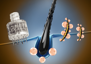 Ribeskin Hairlopecia Meso Complex Shooter (Pink HL)